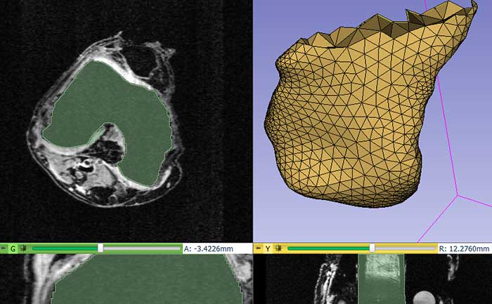 3D Slicer Based Application