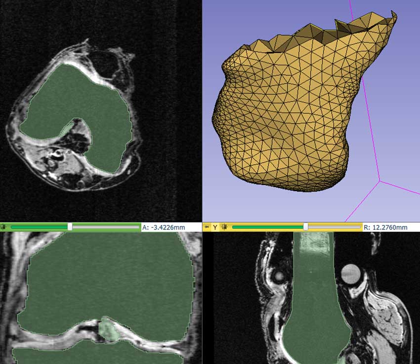 Computer visualizations