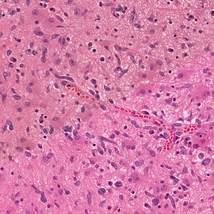 Microscoptic cells featuring color conversion from upper left to bottom right.