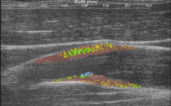 Ultrasound Systems