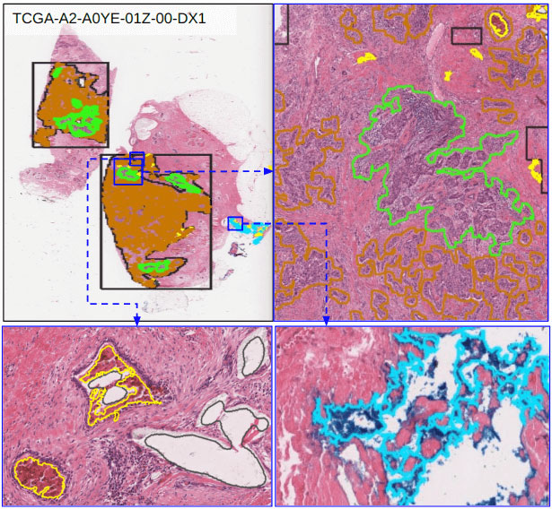 HistomicsTK screenshot of cells