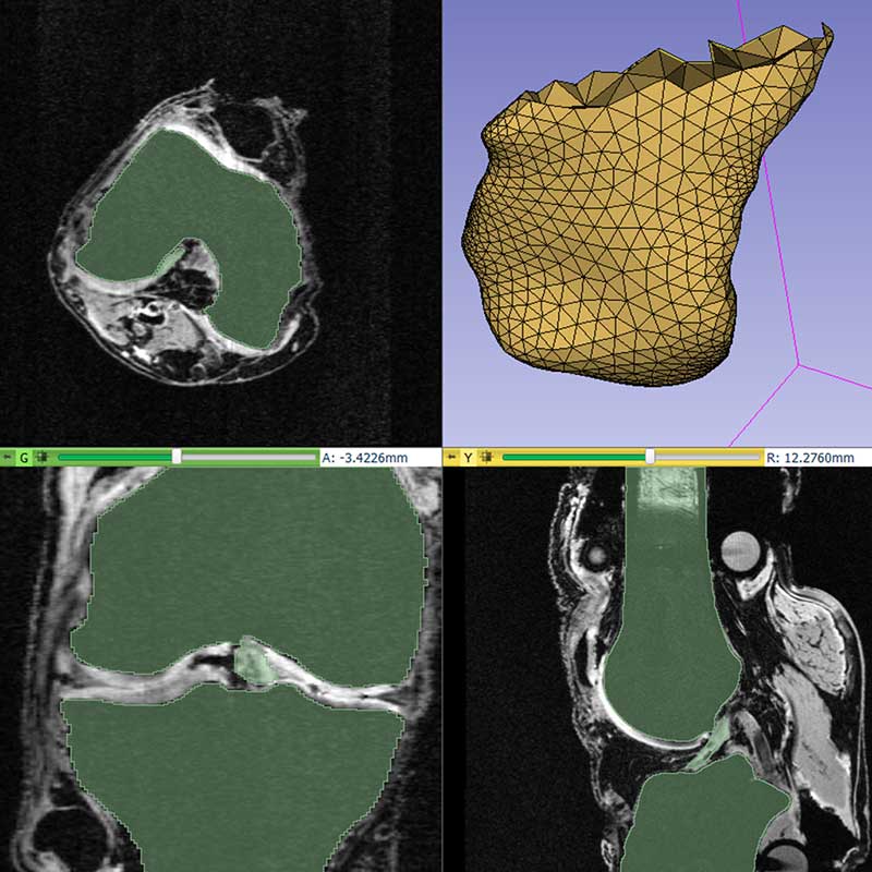 visualization of an internal organ