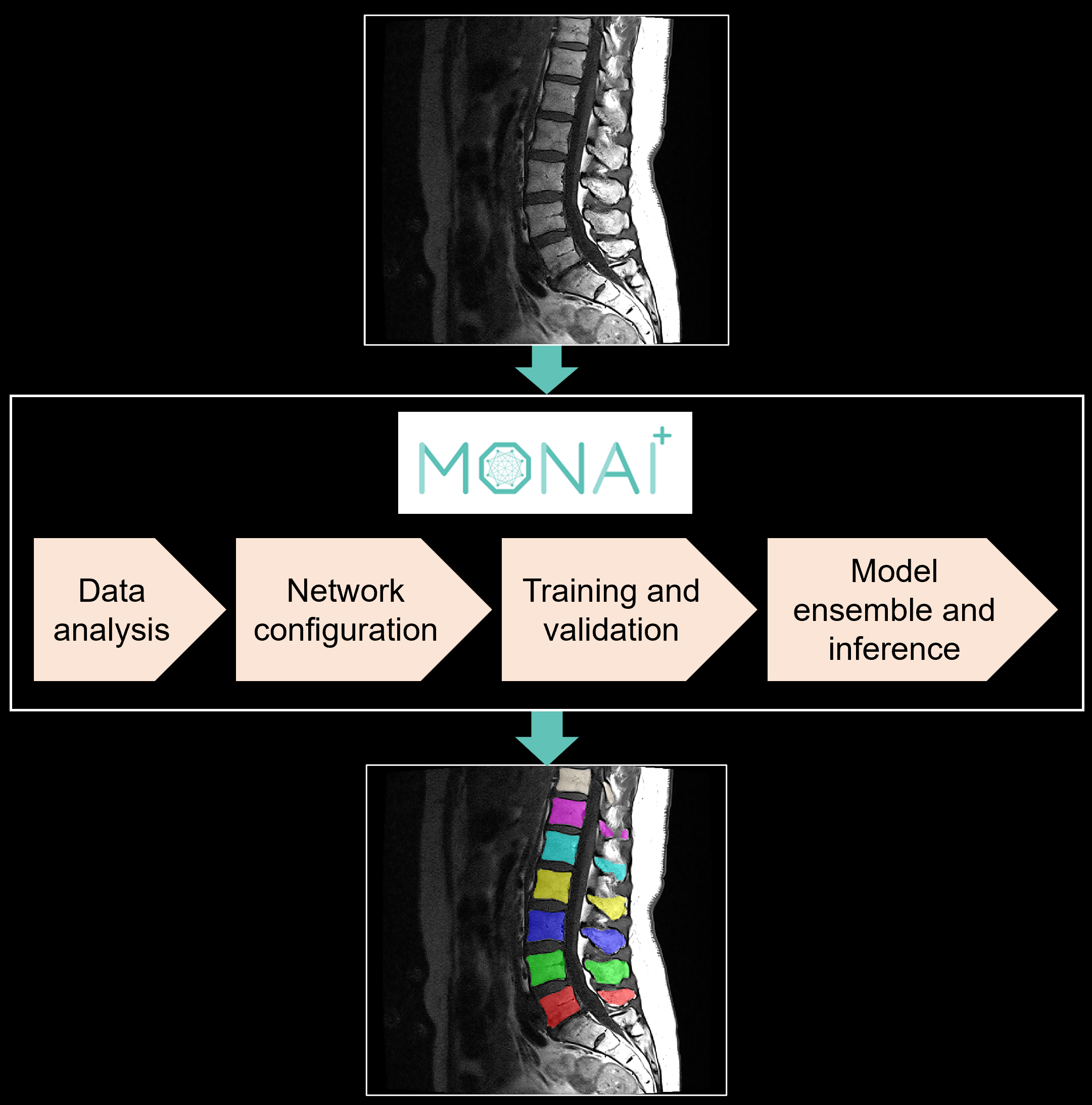 Illustration of out-of-the-box segmentation pipelines in MONAI