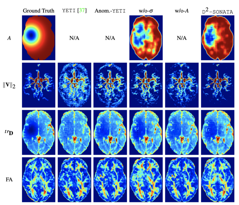 Reconstruction comparisons of normal and abnormal brains